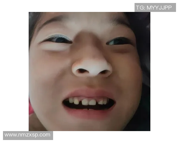 足球球星换牙事件揭秘 从牙齿到笑容的背后故事